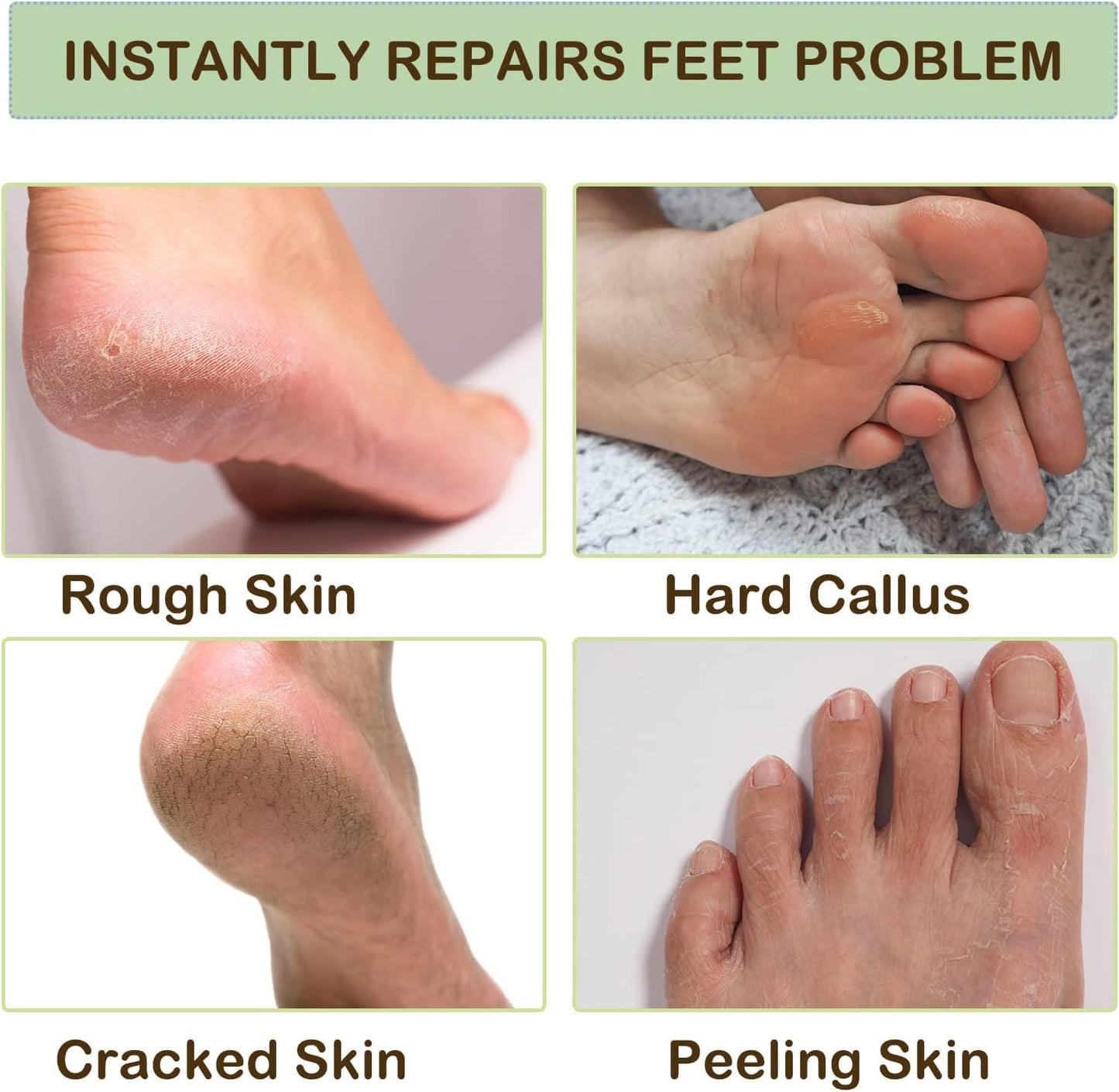 Silicone Spa Gel Socks for Women & Men Crack Heel Repair