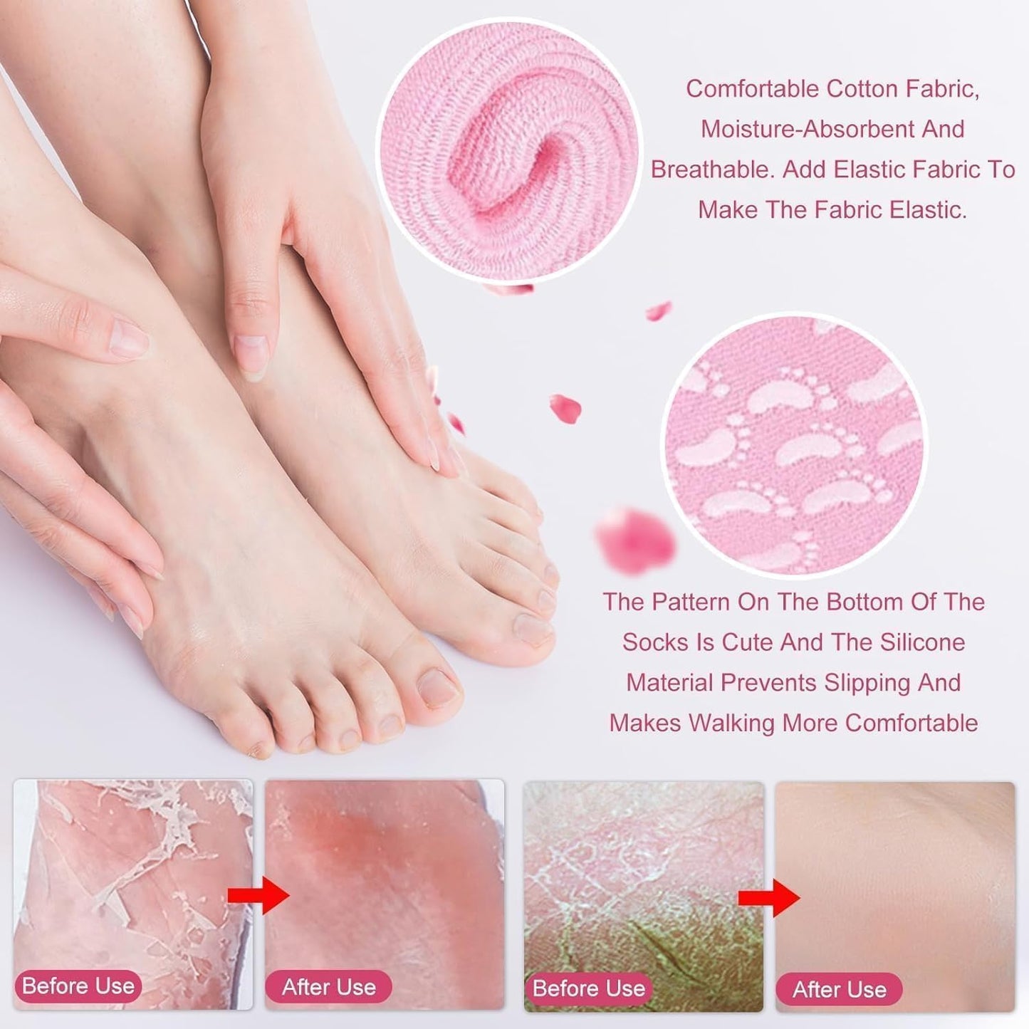 Silicone Spa Gel Socks for Women & Men Crack Heel Repair